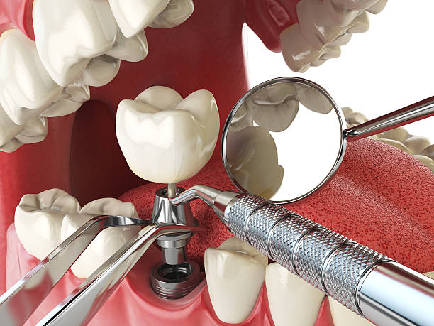 Best Cracked Tooth Emergency Dentist  in Wesleyville, PA
